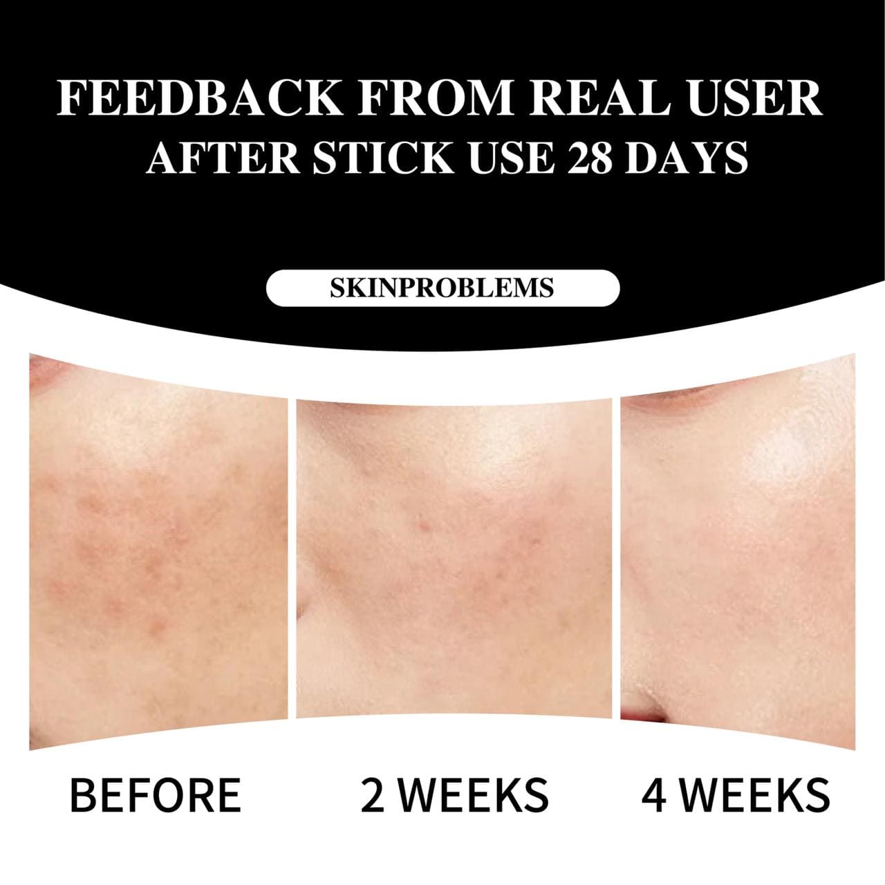 5-in-1 Age Defense Serum